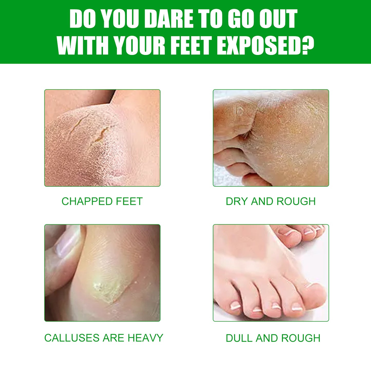 EELHOE Aloe Vera Foot Mask, Moisturizing Anti-Cracking, Dead Skin Removal, Tender Skin Care Foot Mask